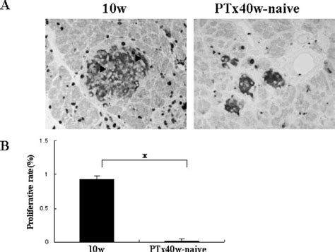 Representative Features Of Extranuclear Insulin And Nuclear Ki 67 A