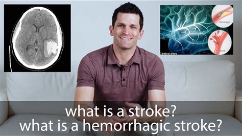 Hemorrhagic Stroke // everything you need to know | Stroke Recovery Tips