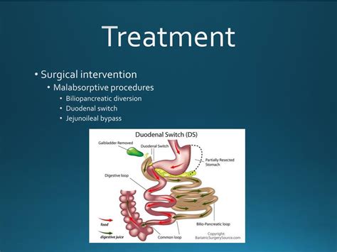 PPT - Morbid Obesity PowerPoint Presentation, free download - ID:2670929