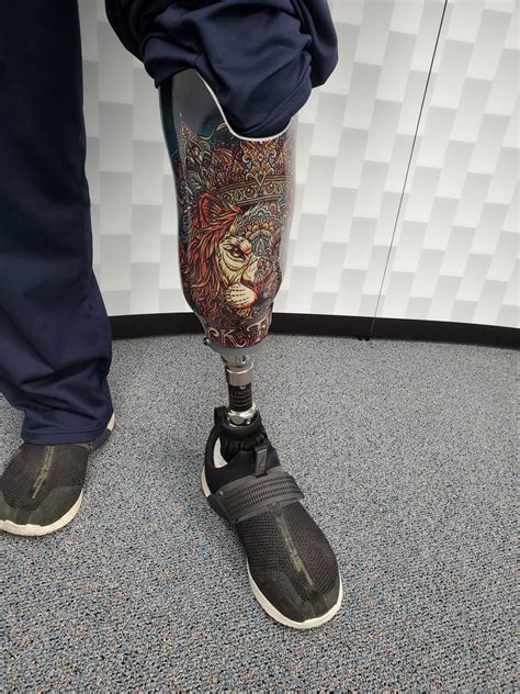 Custom Socket Art For Lower Body Prosthetics United Prosthetics