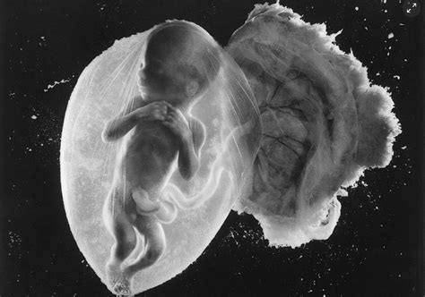 Amazing Image Of Unborn Baby At 18 Weeks Is Called The Photograph Of