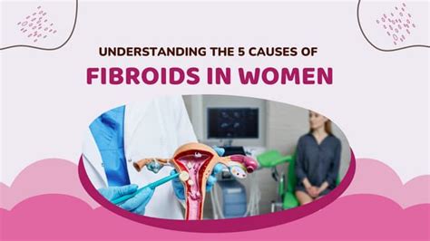 UNDERSTANDING THE 5 CAUSES OF FIBROIDS IN WOMEN | PPT | Free Download