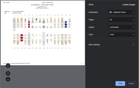 Print Dental Chart Odontogram – CareStack: User Resource Center