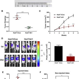 MTF2 Knockdown Suppressed Proliferation Migration And Invasion Of HCC