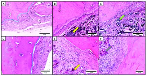 Histological Sections Of Rat Calvaria After Ostectomy With And Without