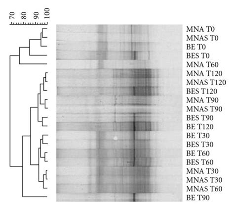 Denaturing Gradient Gel Electrophoresis Dgge Fingerprints Of