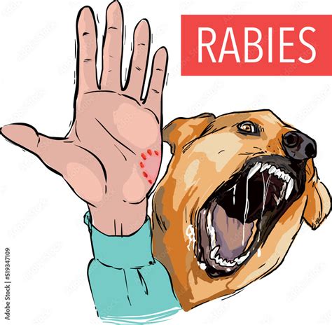 Dog Bite Clipart