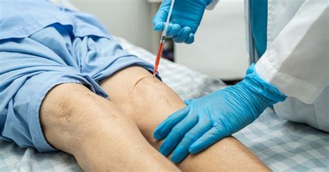 Heal From Within The Power Of Platelet Rich Plasma Prp Injections