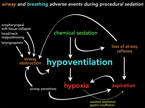 The Procedural Sedation Screencast Trilogy – emupdates