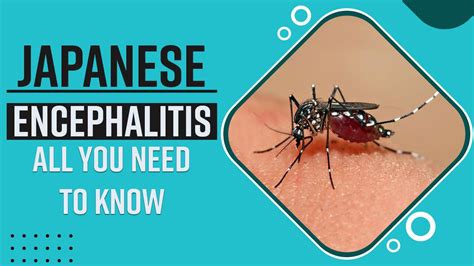 Japanese Encephalitis: Symptoms, Causes And Treatment, All You Need To Know - Watch Video