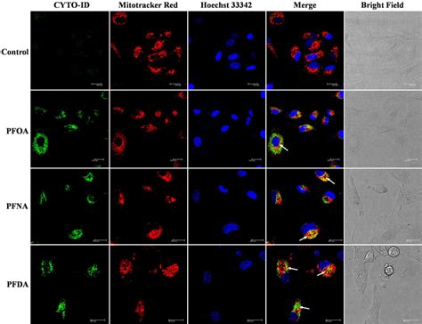 Mitochondrial Autophagy Co Localization Of Lc With Mitotracker Red