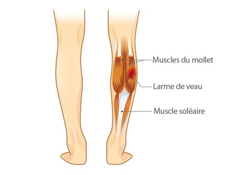 Douleurs au mollet causes symptômes et traitements