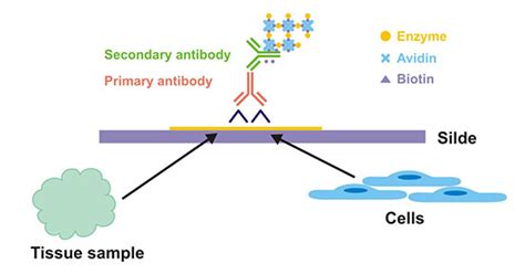 免疫组化IHC与病理诊断 武汉华美生物工程有限公司