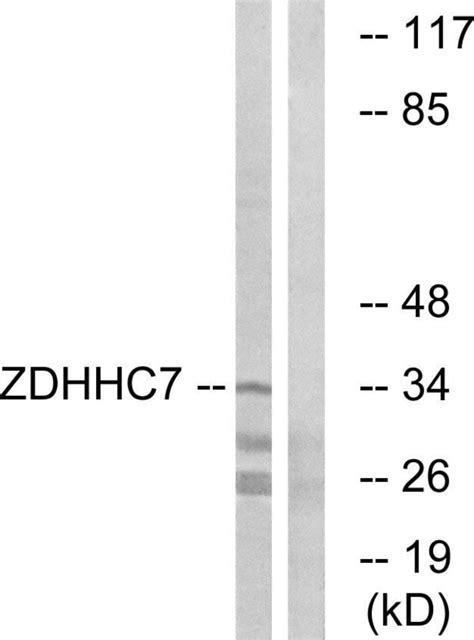 ZDHHC7 Polyclonal Antibody Invitrogen 100 μg Unconjugated Anticuerpos