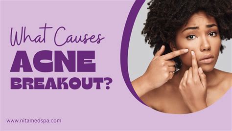 What Causes Acne Breakouts? - Nita Med Spa