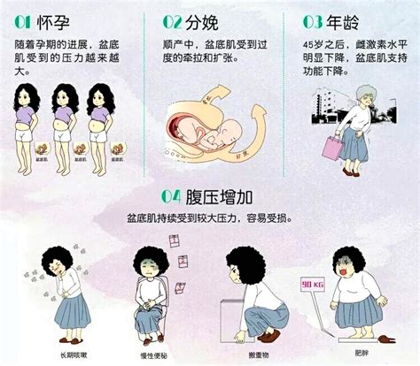 促进盆底肌康复护航女性健康性福 西安市妇幼保健院