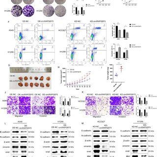 Circrapgef Promotes Proliferation Migration Invasion And Emt Process