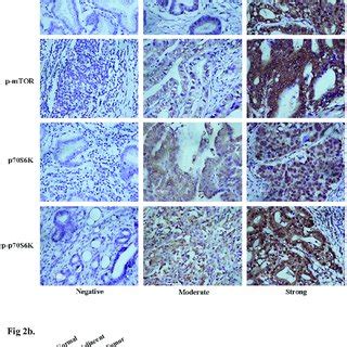 A Immunohistochemical Ihc Staining Of Mtor P Mtor P S K And