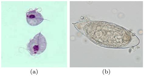 Images of some commonly found parasite eggs in urine samples of animal ...