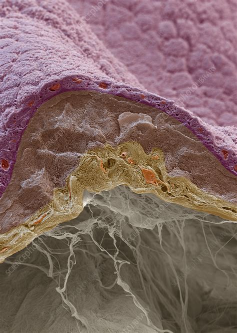 Amniotic sac, SEM - Stock Image - C056/2262 - Science Photo Library