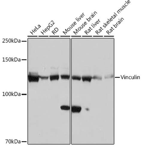 Vinculin Recombinant Monoclonal Antibody 3j7p3 Ma5 42795