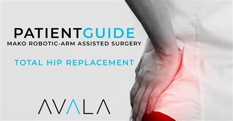 A Patient S Guide To Mako Robotic Arm Assisted Surgery For Total Hip Replacement