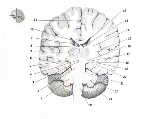 coupe frontale de l encéphale Diagram Quizlet