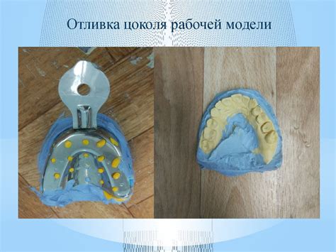 Технология изготовления цельнолитой коронки на моляр - презентация онлайн