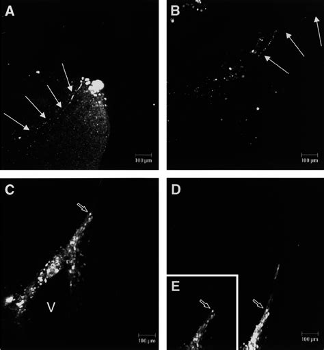 Detection Of Egfp Autofluorescence In Brain Tissue From Mvegfp Infected