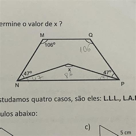 O Trapézio Isósceles Mnpq Determine O Valor De X Explicação Por Favor