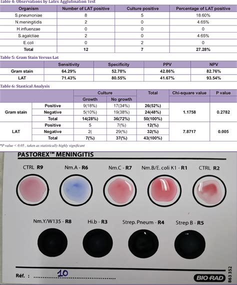 Table 2 from Evaluation of Latex Agglutination Test Efficacy in Diagnosis of Acute Pyogenic ...