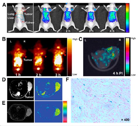 Multimodality Tumor Imaging Using Cmbp Ga Atp Spions A In Vivo