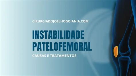 Instabilidade Patelofemoral Causas E Tratamentos Ortopedista