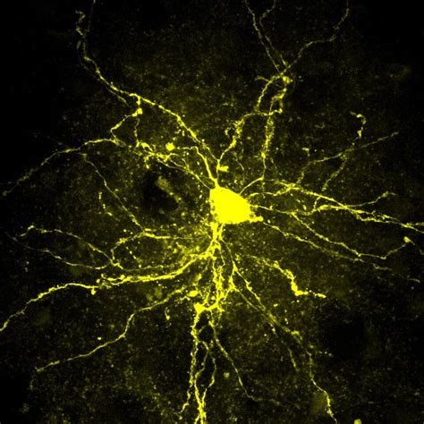 Examining The Gene Environment Interactions That Drive Autism