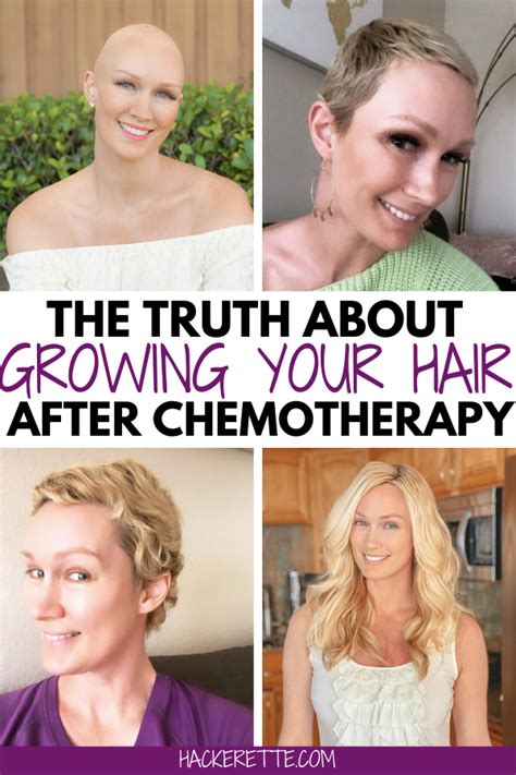 Chemotherapy Side Effects Hair Loss