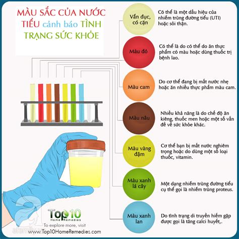 Nước Tiểu Màu Gì Là Tốt Khám Phá Bí Mật Sức Khỏe Qua Màu Sắc Nước Tiểu