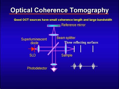 Lecture Optical Coherence Tomography Oct Basic Principles