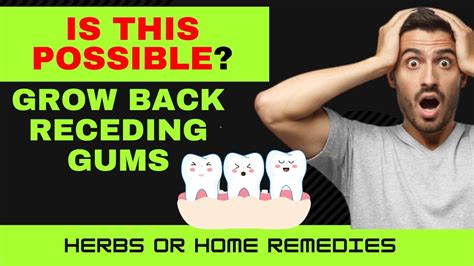 How To Grow Back Receding Gums Naturally 4 Simple Ways To Grow Back