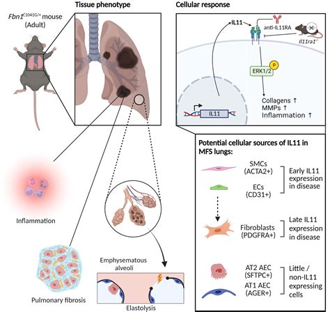 Il11 Interleukin 11 Causes Emphysematous Lung Disease In A Mouse Model Of Marfan Syndrome