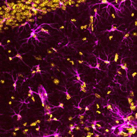 Astrocytes Image Eurekalert Science News Releases