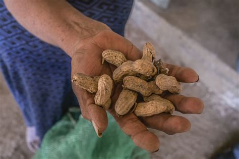 Peanut Allergy Symptoms In Toddlers Eased By Viaskin Skin Patch Dbv