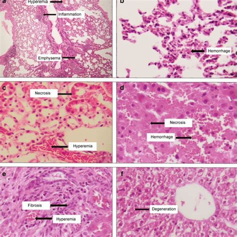 Photomicrographs × 400 Of Hande Stained Testicular Tissue Sections Of