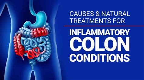 Recording: Natural treatments for inflammatory Colon Conditions ...