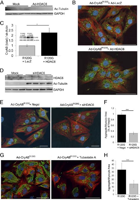 Tubulin Acetylation Status Influences Aggregate Formation In Cryab