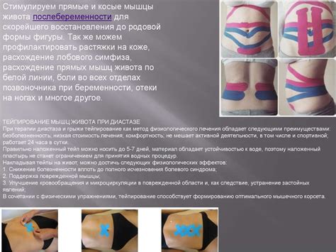 Кинезиотейпирование. История кинезиотейпирования - презентация онлайн
