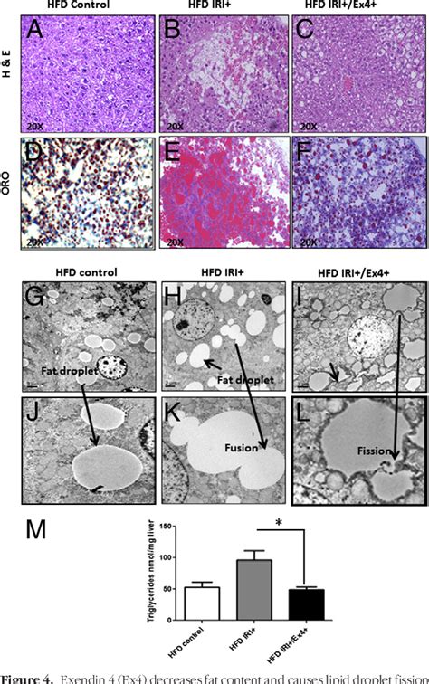 Figure 1 From The Glucagon Like Peptide 1 Receptor Agonist Exendin 4 Has A Protective Role In