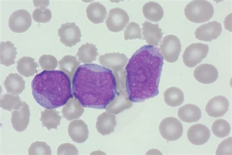 Blood Cell Morphology Newsletter And Training Tool