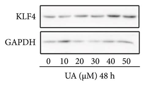 Ua Inhibited The Growth Of Gc Bgc 823 Cells Through Upregulation Of