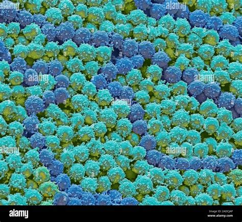 Lactococcus bacteria. Scanning electron micrograph (SEM) of Lactococcus ...