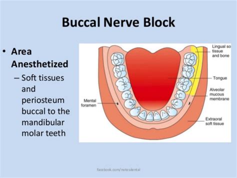 Local Anesthesia Exam Flashcards Quizlet